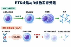 BTK功能正常时，B系细胞发育成熟并形成可分泌抗体的浆细胞。BTK功能丧失使B细胞发育受阻，成熟B细胞显著减少，免疫球蛋白水平降低。箭头表示发育过程与缺陷的作用位置。