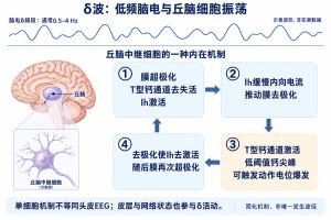 δ波专业示意图