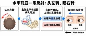 前庭-眼反射专业示意图